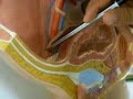 Medicina Facimed, Anatomia Sistema Reprodutor Masculino.