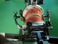 U/L Dentures, wax set-up, using a \"Precision Coordinator\" Ar U/L Dentures, wax set-up, using a \"Precision Coordinator\" Ar