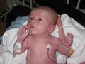 Landen's CDH Journey