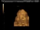 Baby Bowker Baby Bowker