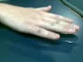 arthur hand sweat
