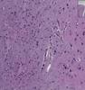 Shotgun Histology Brain
