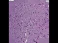 Shotgun Histology Brain