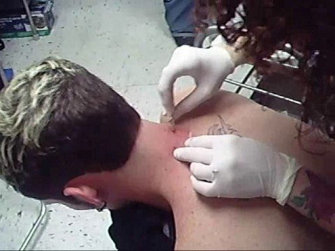 My friend getting a surface piercing on the back of his neck.