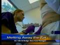 Lipodissolve Video on CBS