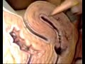 Female Repro: Internal Genitalia Female Repro: Internal Genitalia