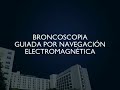 Broncoscopia guiada por navegación electromagnética