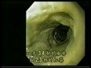Enagic-Dr. Hiromi Shinya Part 1