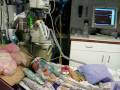 Emily playing on BiPAP :: RSV 2008 - free flv video @ vwatch.tv