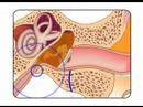 how to relieve otitis media pain