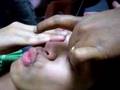 eyebrow-threading
