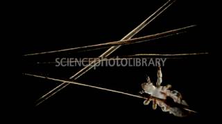 OTC treatments now nearly ineffective for head lice