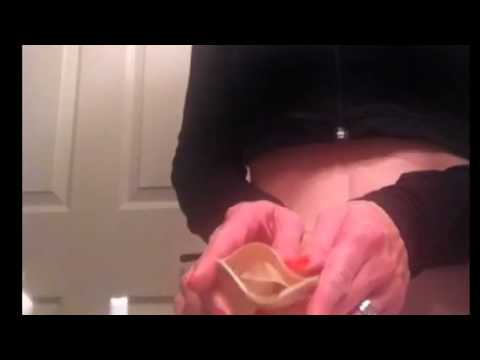 how to drain ileostomy bag