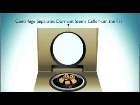 how to harvest t cells