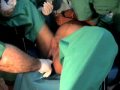 Video Childbirth - Parto vaginal natural en madre de 16 años de edad !!