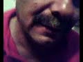 black heads black heads