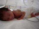 premature infant