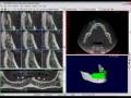 videos de Bioparts - Tutorial 5 DentalSlice: Janela Cross