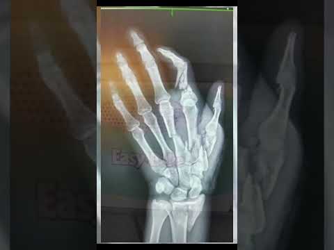 Terrifying Toys That Will Haunt Your Nightmares! #youtubeshorts #shorts