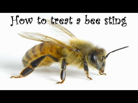 how to treat swelling from a bee sting