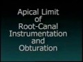 Limite Apical de Obturação - Parte 1