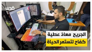 الجريح معاذ عطية من مخيم العين في نابلس يتحدى ويفتتح مشروعه الخاص