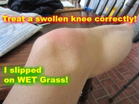 how to relieve swelling