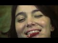 Management del dolore post operatorio - Auff!! http://www.youtube.com/watch?v=Xj_hyGSdPuc