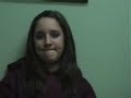 14 yo dancer spinecor brace, Testimonial 18
