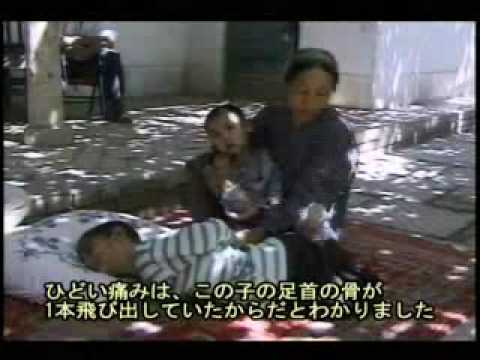 Chinese nuclear tests in East Turkestan 1of3