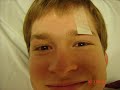 Surgery of the eye Surgery of the eye