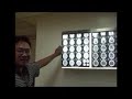 Brain Operation in Butuan in Ilonggo Cebuano Visaya 1D