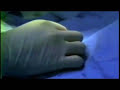 Birth As We Know It: Circumcision