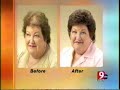 Female Hair Loss Restoration and Replacement