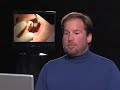 No Needle, No Drill, Cavity and Filling Demonstration