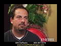 Neck Lift / Chin Implant / Rhinoplasty Part 1, Dr. Cruise