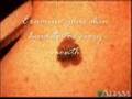 Skin cancer (Melanoma) PSA
