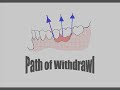 Dental Surveying