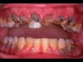 wwe wwf Kane as Dr. Isaac Yankem DDS Video wwe wwf Kane as Dr. Isaac Yankem DDS Video