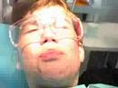 Getting My Braces! Stage 4 Expander Coming Off