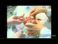 Chinese infant born with 2 heads