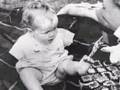 THalidomide-montage-
