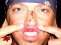 Bret%20Michaels%20Stays%20Positive%20About%20Tonys%20Mishap