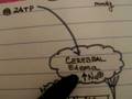 Cerebral Ischemia