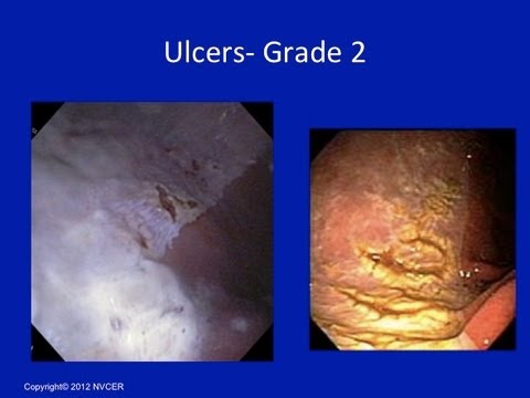 how to treat equine ulcers