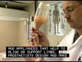 TypeFocus Careers: Orthotists and Prosthetists