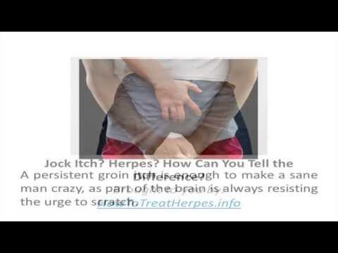 how to cure jock itch rash