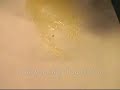 Glue Moat - Hot Melt Rodent Trap Assembly - GlueTrap Glue Moat - Hot Melt Rodent Trap Assembly - GlueTrap