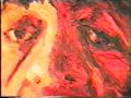Thumbnail #3