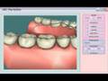 PerioSim: Haptics-Based Periodontal Simulator